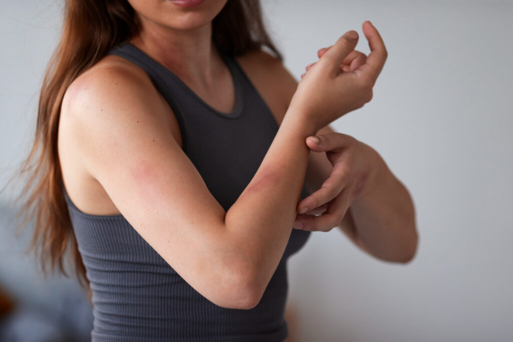 Woman Suffering From Rash 1024x683